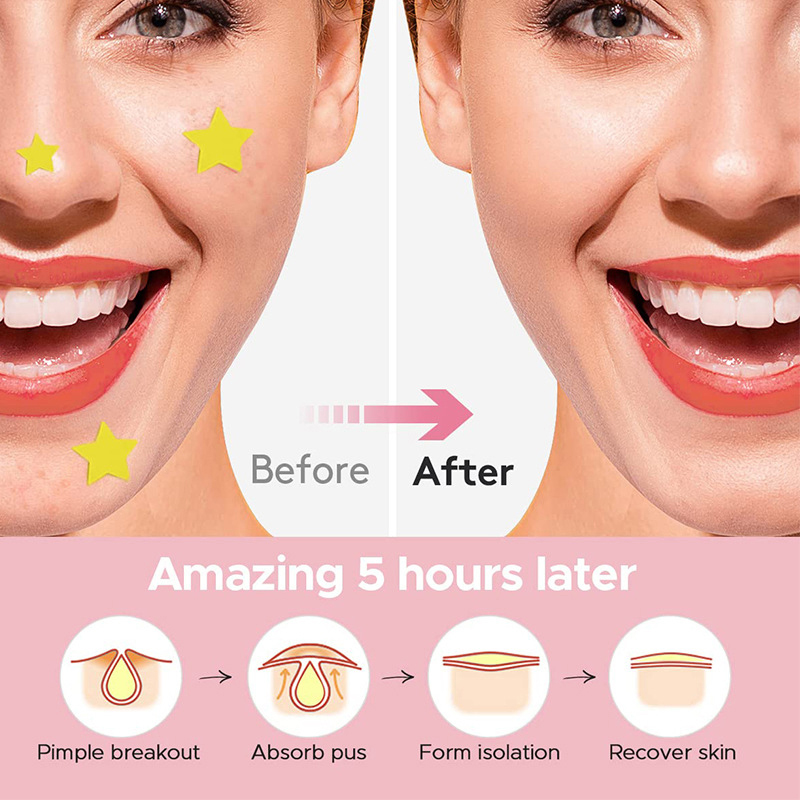 600 sztuk/zestaw Plasterki na  – Beauty For You Makeup recenzja i cena